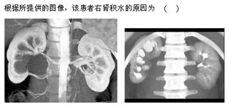 2013年高级卫生专业技术资格考试 放射医学练习题及答案（1月6日放射卫生技术服务专题）